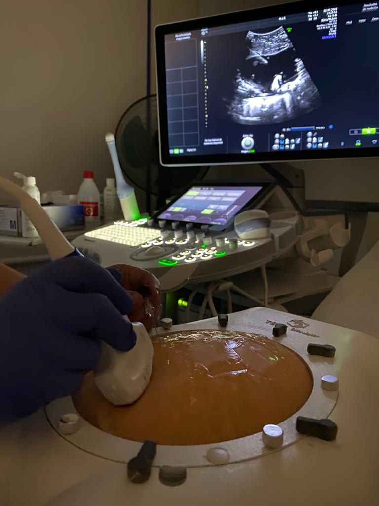 Un nuevo simulador en obstetricia