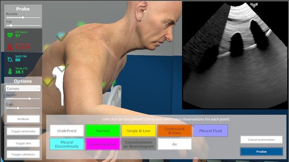 Lung Ultrasound Simulator: uno strumento gratuito per le simulazioni di ecografia polmonare